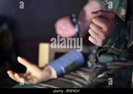 (190220) -- HAMA, 20 février 2019 (Xinhua) -- Un officier militaire amputé tente une prothèse de main dans la province de Hama Rabia, centrale de Syrie, le 18 février, 2019. Ali Bakeer, un étudiant en ingénierie médicale en Syrie, a mis au point une prothèse de main destiné à aider les personnes handicapées qui ont subi des blessures pendant la guerre. Né dans la ville de Rabia dans la province centrale de Hama, le jeune homme de 22 ans, qui est un étudiant de troisième année, a déclaré qu'il avait un fort intérêt pour l'électronique comme un garçon. L'idée de créer la prothèse de la main a été motivée par les besoins des blessés pendant la guerre, d'après Banque D'Images