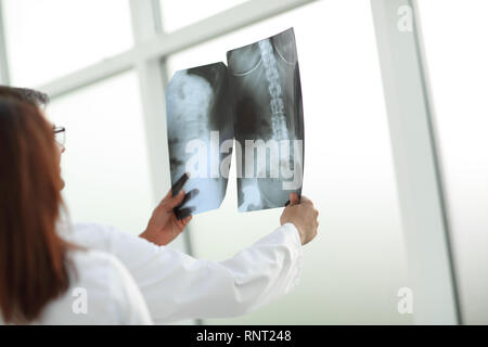 Groupe des médecins de discuter le dossier du patient x-ray. Banque D'Images