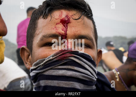 Caracas, Venezuela. Feb 23, 2019. 23 février 2019, la Colombie, Bogota : un manifestant blessé est traité au pont international par la police colombienne. Plus de 280 personnes ont été blessées dans des affrontements à la frontière et le déploiement des forces de sécurité vénézuéliennes sur le territoire colombien le samedi, plus de 35 d'entre eux a dû être emmené à l'hôpital. Credit : Elyxandro Cegarra/ZUMA/Alamy Fil Live News Banque D'Images