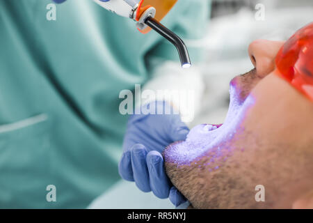 Close up of dentiste blanchiment des procédure pour patient Banque D'Images