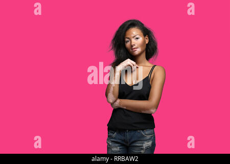 Belle fille africaine en studio avec des problèmes de peau Vitiligo. studio tournage. Sur le fond de couleur rose avec de l'espace libre pour votre texte Banque D'Images