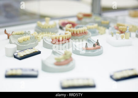 Orthodontie appareil dentaire. Outils pour faire une prothèse dentaire, dents moulées. Dents de moulage. Banque D'Images