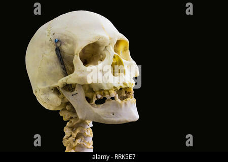 Os du crâne humain articulé et vertèbre cervicale pour l'anatomie de la tête et du cou en arrière-plan noir isolé avec de l'espace pour le texte Banque D'Images