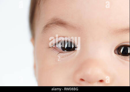 Sur l'allergie avec des yeux de bébé normale vue rapprochée Banque D'Images