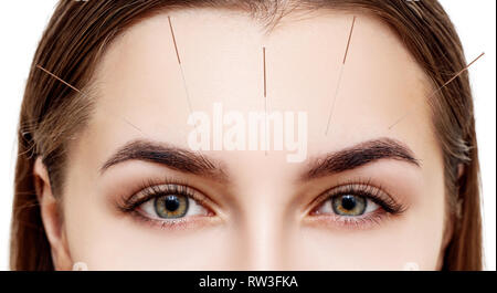 Jeune visage de femme avec des aiguilles insérées. L'objet d'un traitement d'acupuncture Femme Banque D'Images