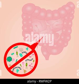 L'infection au virus de l'intestin grêle sign vector illustration Illustration de Vecteur
