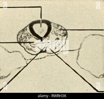 L'embryologie embryologie embryologie (1949) Année : 1949 bart00MÉSENCÉPHALE AORTE aorte ventrale du mésenchyme Fig. 131. Une coupe dans le mésencéphale d'un embryon de poulet de 33 heures. La partie antérieure est une cavité en forme de V, et sa frontière ventrale est en contact avec la tête de l'épiderme. Au-dessus de l'intestin antérieur sont les aortes dorsales et ci-dessous, les aortes ventrales. L'avenir arcs aortiques permettra de relier ces navires. Aorte dorsale MÉSOCARDE DORSAL EPIMYOCARDIUM Banque D'Images