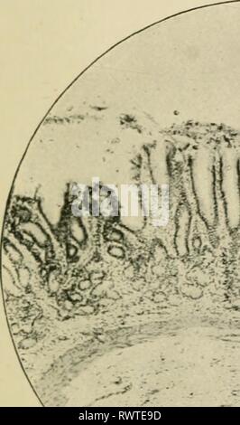 Éléments d'histologie (1898) Éléments d'histologie elementsofhistol00klei Année : 1898 l'estomac. 13 condition de granules dans les cellules. En granulés sont observables ])oth dans les cellules pariétales et centrale ; ils sont plus visibles et plus facilement j^réservés dans ce dernier. 264. Le^g pylorique laiids (Fig. 202).-^^t c c nécessaire à l'^ iM Banque D'Images