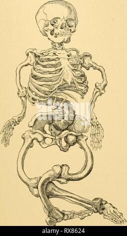 Les effets de l'inanition et les effets de l'inanition et de la malnutrition sur la croissance et la structure des effectsofinaniti00jack Année : 1925 EFFETS SUR LE SQUELETTE !43 Pfaundler ('22). Certaines de ces modifications sont indiquées à la fig. 43 et 52. Des lésions semblables ont été décrites par de nombreux chercheurs dans différents animaux, en particulier les chiots et les rats, pendant le rachitisme expérimental. Bien qu'il est souvent affirmé que la croissance du squelette est retardée pendant le rachitisme, mais peu de données sont disponibles sur les poids frais du squelette à l'appui de ce point de vue. Trousseau et Lasegue ('50) a noté un poids sec de sur Banque D'Images