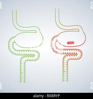 Virus de l'intestin de l'icône . Simple illustration de l'intestin virus vecteur icône pour web design isolé sur fond blanc Illustration de Vecteur