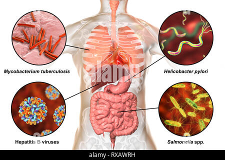 Les bactéries qui causent les infections humaines, illustration Banque D'Images