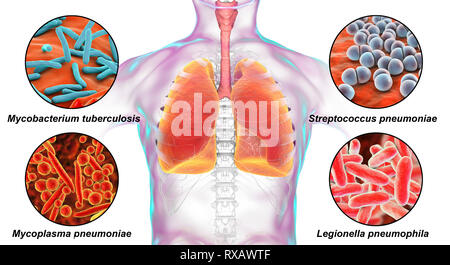 Les bactéries qui causent des infections pulmonaires, illustration Banque D'Images