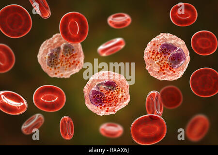 Frottis sanguin avec de nombreux éosinophiles, illustration Banque D'Images