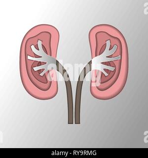 Modèle de coupe de papier d'une maladie rénale. Des pierres dans les reins. Pyélonéphrite. La maladie de l'urolithiase Illustration de Vecteur