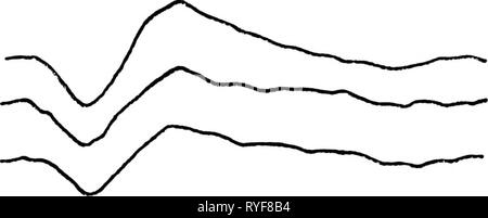 Effets du traitement phonétique et sur la pertinence de stimulation de la réponse évoquée auditive. effectsofphoneti00silv Année : 1977 Banque D'Images