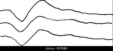 Effets du traitement phonétique et sur la pertinence de stimulation de la réponse évoquée auditive. effectsofphoneti00silv Année : 1977 cv. Banque D'Images