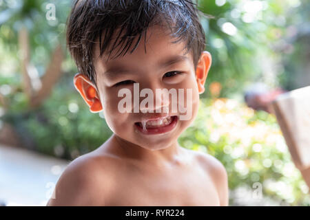 Close up de mucus nasal, Asian boy a un écoulement nasal clair avec morve. Banque D'Images