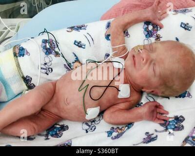 Jour 5 Un Vieux Bebe Ne Premature A 31 Semaines Pesant 1kg Le Bebe Souffre Avec Syndrome De Detresse Respiratoire Et D Une Jaunisse Photo Stock Alamy