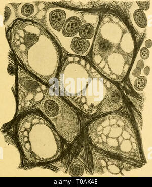 Les effets de l'inanition et Banque D'Images