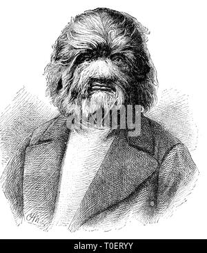 Fedor Jeftichew Yevtishchev Adrianovich, Fyodor, geboren 1868 gestorben, 1904, Jo-Jo le Dog-Faced Boy, homme Dog-Faced / Fedor Jeftichew Yevtishchev Adrianovich, Fyodor, né 1868, est mort en 1904, mieux connu sous le nom de Jo-Jo le Dog-Faced Dog-Faced Boy, l'homme, artiste russe sideshow Banque D'Images