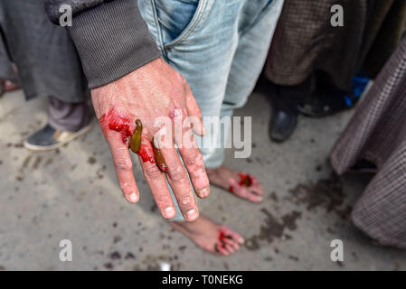 Un homme vu du cachemire avec les sangsues sur la main au cours de la traitement de la sangsue. Un travailleur de la santé traditionnelle utilise les sangsues pour sucer le sang impur dans le cadre d'un traitement à l'Hazratbal sur les rives de la Dal Lake, dans la banlieue de Srinagar, capitale d'été du Cachemire indien. Chaque année, les travailleurs de santé traditionnels au Cachemire utiliser les sangsues pour traiter les personnes des démangeaisons douloureuses, morceaux qui se développent sur la peau appelé engelures acquis durant l'hiver. Des milliers de patients souffrant de divers problèmes de peau reçoit un traitement à la sangsue à Srinagar Hazratbal. Banque D'Images