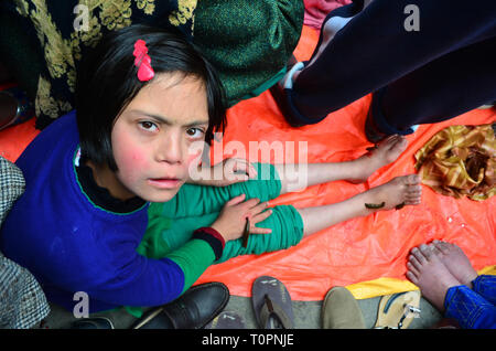 Cachemiris prendre Leech traitement sur les rives du lac Dal Srinagar, Cachemire indien le 21 mars 2019. Mar 21, 2019. Le traitement traditionnel est organisée chaque année le jour de Nauroz (Jour de l'An iranien). Les guérisseurs utilisent les sangsues de sucer le sang impur des patients qui ont une peau, le froid ou le gel des maladies. Credit : Muzamil Mattoo/IMAGESLIVE/ZUMA/Alamy Fil Live News Banque D'Images