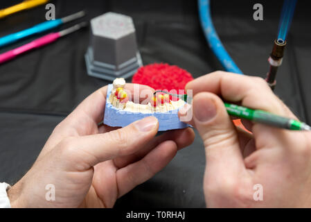 Technicien dentaire ou un dentiste avec un homme travaillant dans un laboratoire de prothèses avec de la cire sur un modèle de la mâchoire Banque D'Images
