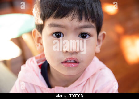 Close up de mucus nasal, Asian boy a un écoulement nasal clair avec morve. Banque D'Images