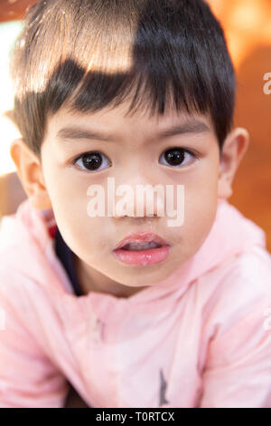 Close up de mucus nasal, Asian boy a un écoulement nasal clair avec morve. Banque D'Images