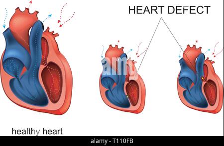 Illustration vecteur de maladie cardiaque, cardiologie vice. Illustration de Vecteur