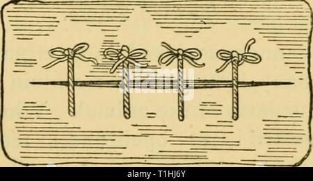 Maladies et affections des maladies et troubles de l'alimentation du cheval : un traité sur la médecine et de la chirurgie équines diseasesdisorder00gres Année : 1886 Les illustrations ci-dessus montrent, d'abord, deux aiguilles à suture commun, et deuxièmement de Simpson et à l'aiguille. Suture interrompue, Banque D'Images