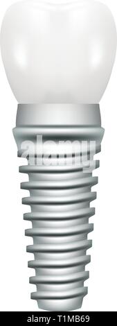 Modèle d'Implant dentaire libre de découper sur le côté médical poster éducatif isolé sur un fond blanc. Vector Illustration. Illustration de Vecteur