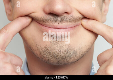 Les lèvres de sourire. Sourire faux concept sur l'homme face Banque D'Images