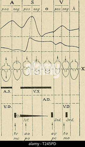 Image d'archive à partir de la page 250 des Orientations pour le travail en laboratoire dans les Orientations pour le travail en laboratoire de physiologie à l'usage des étudiants en médecine, directionsforlab00lomb Année : 1914 PUI VEINEUX.SK 221 II IIIX IV VI Fig. 41. Diagramme montrant les relations de l'évolution de la taille de l'oreillette droite et le ventricule au pouls veineux, le pouls carotidien, moment de bruits du cœur, et de la chaux de la fermeture des soupapes. Banque D'Images