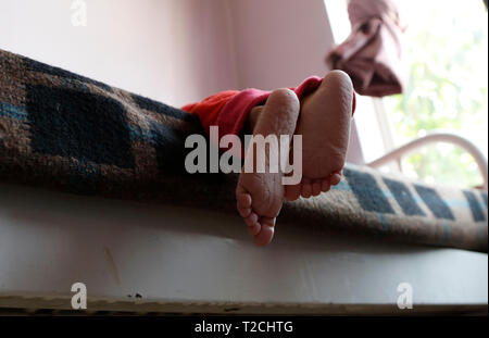 Sanaa, Yémen. 1er avril 2019. Les pieds d'un enfant malnutri sont vus dans un centre de soins de la malnutrition dans la région de Sanaa, Yémen, le 1 avril 2019. Selon l'Organisation des Nations Unies pour l'enfance (UNICEF), environ 394 000 enfants yéménites de moins de 5 ans souffrent de malnutrition aiguë sévère et nécessiter un traitement. Credit : Mohammed Mohammed/Xinhua/Alamy Live News Banque D'Images