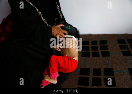 Sanaa, Yémen. 1er avril 2019. Une femme montre son enfant malnutri dans un centre de soins de la malnutrition dans la région de Sanaa, Yémen, le 1 avril 2019. Selon l'Organisation des Nations Unies pour l'enfance (UNICEF), environ 394 000 enfants yéménites de moins de 5 ans souffrent de malnutrition aiguë sévère et nécessiter un traitement. Credit : Mohammed Mohammed/Xinhua/Alamy Live News Banque D'Images