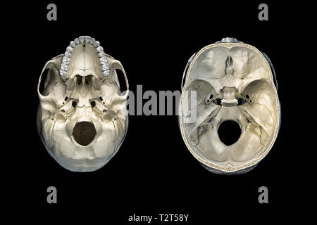 Crâne humain de section transversale et vue de dessous. Sur fond noir. Banque D'Images