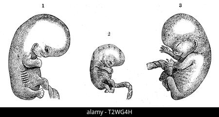 Des embryons humains. 1 8e semaine (taille doublé), 2 neuvième semaine, 3 dixième semaine (2 & 3), 1894 taille naturel Banque D'Images