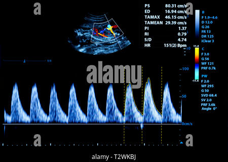 L'image colorée d'échographie modernes moniteur. Machine à échographie. La haute technologie de l'équipement médical et de soins de santé. D'une échographie ou sonogra Banque D'Images