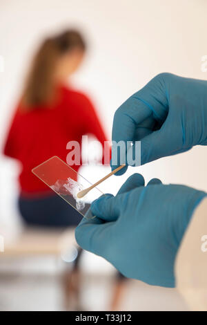 Cancer du col de l'utérus, cancer du col, après un examen de frottis du canal cervical, le prélèvement est examiné au microscope, pour, les changements cellulaires, PAP t Banque D'Images