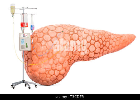 Système de thérapie intraveineuse avec pancreatic. Traitement des maladies du pancréas, rendu 3D concept isolé sur fond blanc Banque D'Images