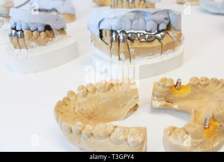 Couronnes dentaires en céramique avec des implants dans un laboratoire Banque D'Images