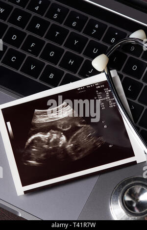 Scan des ultrasons sur l'ordinateur portable de la femme enceinte Banque D'Images