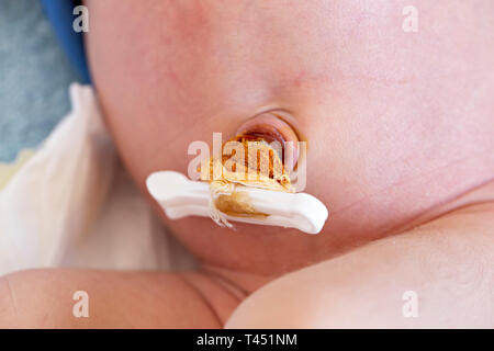 Cordon Ombilical Des Nouveau Nes Avec Le Collier Bebe Ventre Bouton Photo Stock Alamy