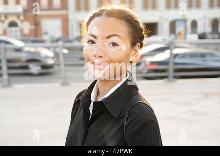 Une belle jeune fille d'origine ethnique africaine avec vitiligo debout sur le printemps chaud manteau noir habillé de la rue ville close up portrait of woman avec s Banque D'Images