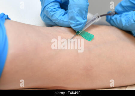 Une aiguille ou canule est insérée dans une veine dans le bras pour prendre le sang d'un patient dans une clinique médicale, basé à l'Université de Bristol. ASSOCIATION DE PRESSE Photo. Photo date : lundi 8 avril 2019. Crédit photo doit se lire : Ben Birchall Banque D'Images