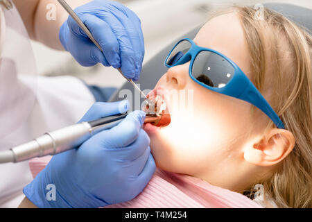 L'exécution de la procédure dentaire dentiste pour une petite fille à la clinique de dentisterie pédiatrique. Médecin à l'aide de brosse sur la tete de la prophy pour polir le remplissage. Enfant calme Banque D'Images