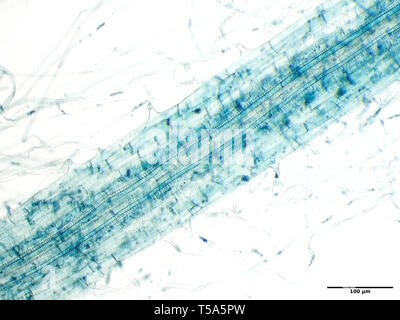 Des semis de navet racine racine avec des poils sous le microscope Banque D'Images