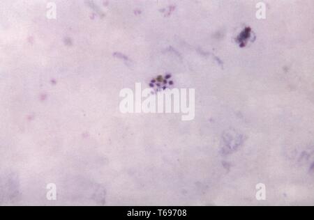 Film épais photomicrographie d'un Plasmodium malariae, schizonte mature non-affichage cytoplasme distinctes contenant 9 mérozoïtes, 1965. Image courtoisie Centres for Disease Control and Prevention (CDC) / Dr Mae Melvin. () Banque D'Images