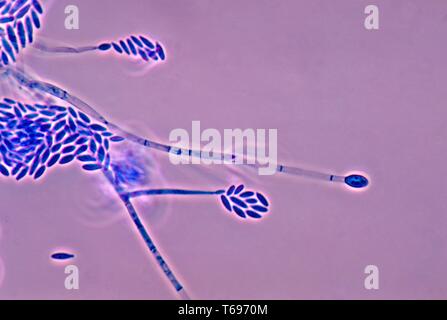 La photomicrographie de conidiophores et conidies du champignon Fusarium verticillioides, 1978. Image courtoisie Centres for Disease Control and Prevention (CDC) / Dr Libero Ajello. () Banque D'Images